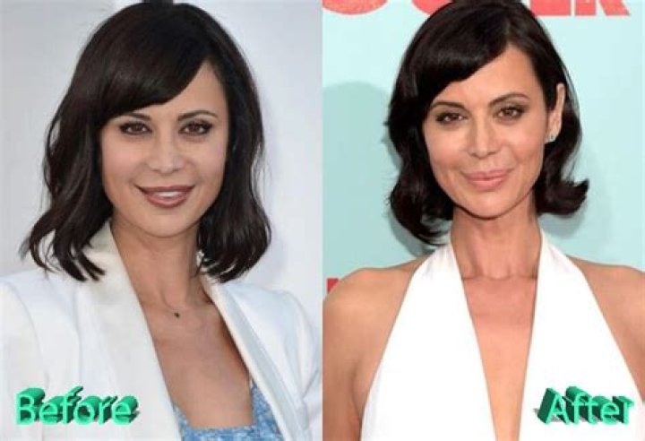 Botox, Facelift, Nose Job, Lip Augmentation & More!