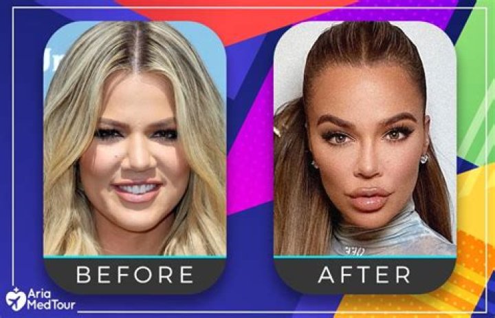Photos Stars Who’ve Admitted To Plastic Surgery – Hollywood Life