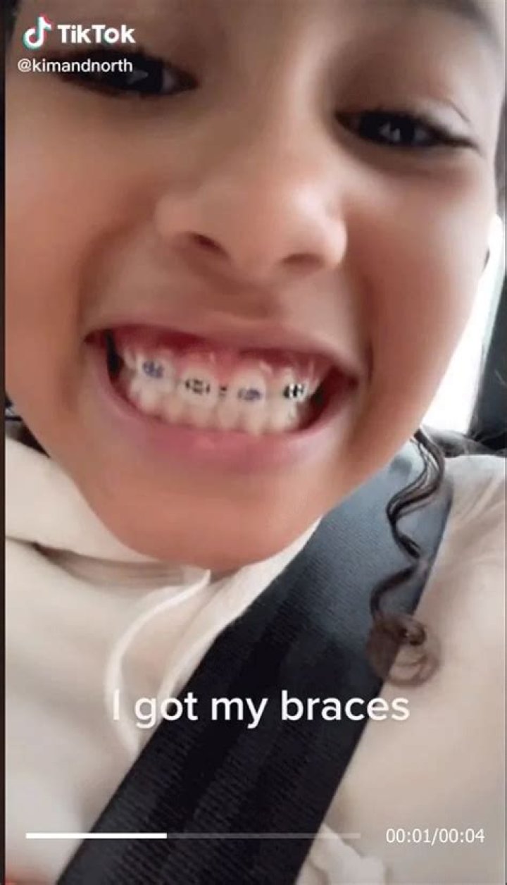 North West Debuts Braces On TikTok – Hollywood Life