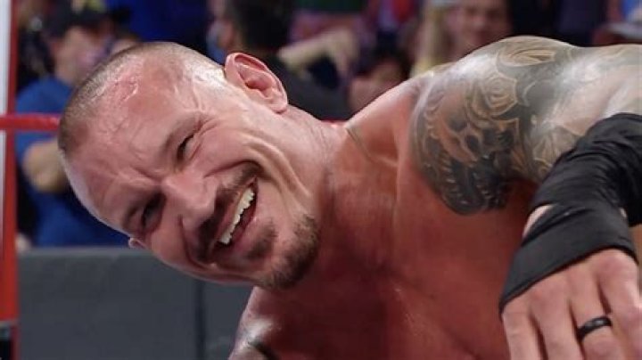 Randy Orton’s Missing Teeth Before And After Pictures