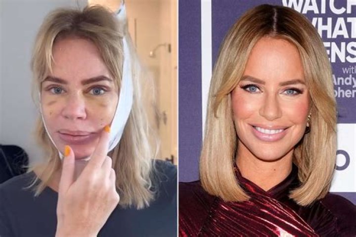 ‘RHODubai’ Star Caroline Stanbury Shows Off Results of Her Face Lift – Hollywood Life